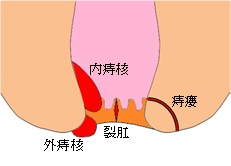 ALTA_1