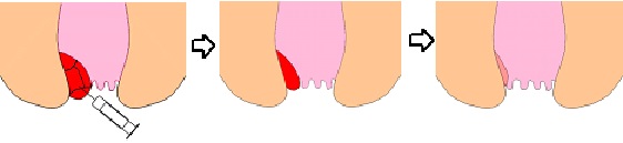 ALTA_2