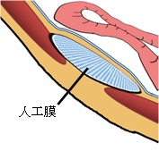 sokei_4